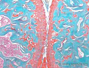 The Wnt inhibitor Tiki2 maintains articular cartilage homeostasis and protects against osteoarthritis | Science Signaling