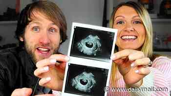 Internet star couple share video explaining that they terminated pregnancy because fetus had Down syndrome... now they've received death threats