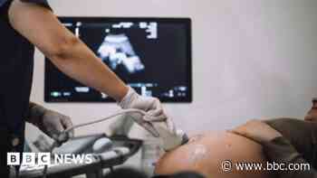 Multiple stillbirths at troubled hospital trust