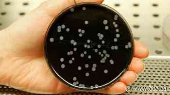 Legionnaires' disease was discovered 50 years ago. Here's what experts say we've learned since then
