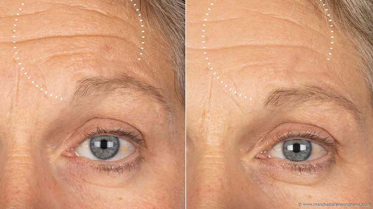 I tried Medik8's new anti-ageing serum with 'next-gen' ingredient said to work in 7 days