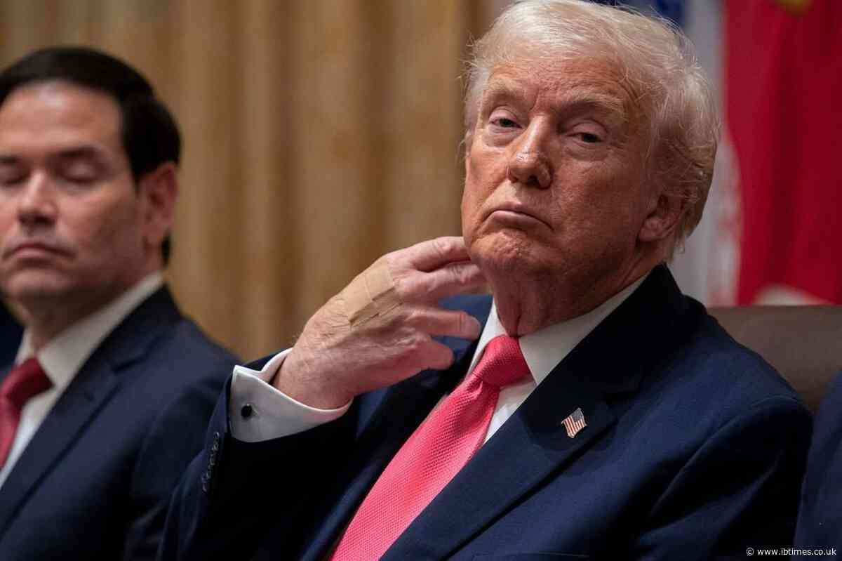 Trump Battered Hands Stir Fresh Health Speculation While Physician Called Physical Exam Totally 'Perfect'