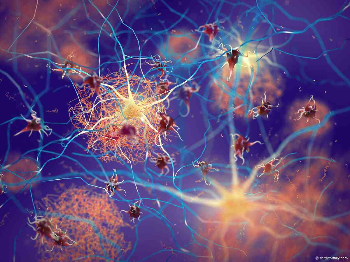 Scientists Discover Key Alzheimer’s “Tipping Point” That May Decide Who Gets Dementia