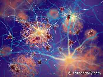 Scientists Discover Key Alzheimer’s “Tipping Point” That May Decide Who Gets Dementia