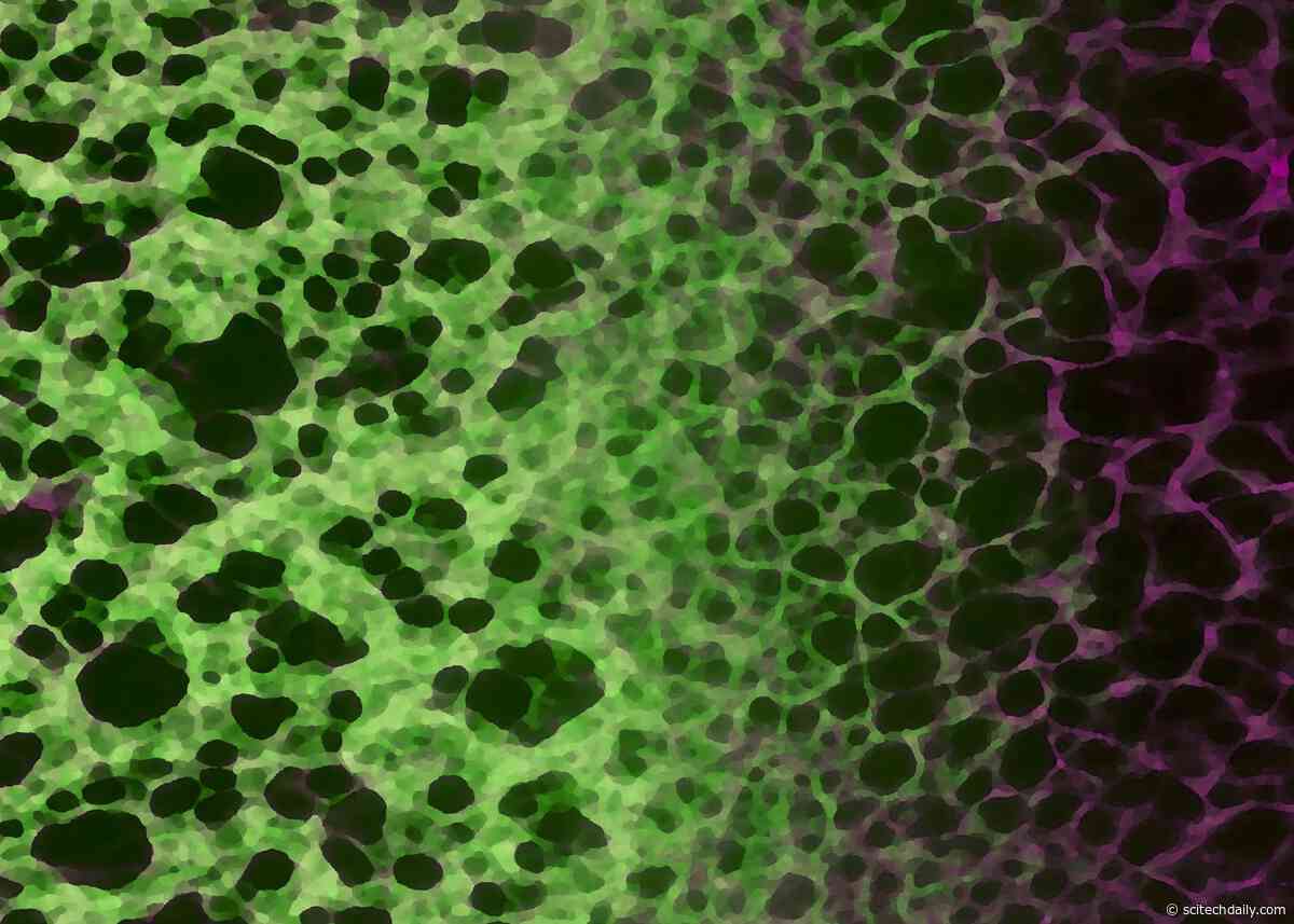 A Newly Found Cellular Shift May Explain Why Aging Leads to Disease