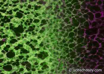 A Newly Found Cellular Shift May Explain Why Aging Leads to Disease