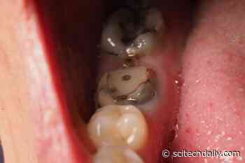This Giant Tropical Fruit Could Hold a Surprising Secret to Saving Teeth