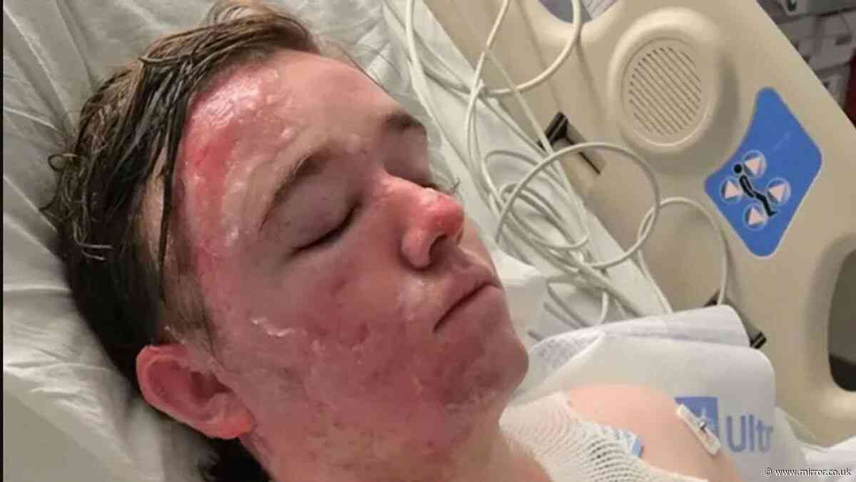 McDonald’s worker suffers serious burns after 'co-worker threw hot oil on him'