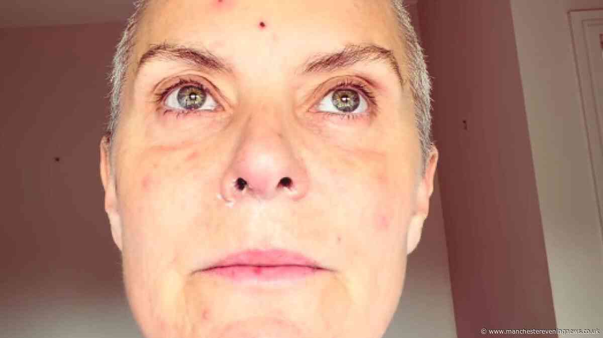 Coronation Street's Tracy Shaw in tears after A&E dash as she undergoes cancer treatment