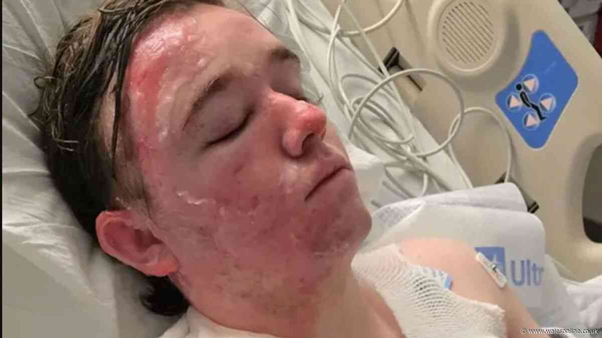 McDonald’s employee has 'hot oil thrown on him by worker' suffering severe burns