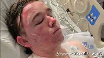 McDonald’s employee has 'hot oil thrown on him by worker' suffering severe burns