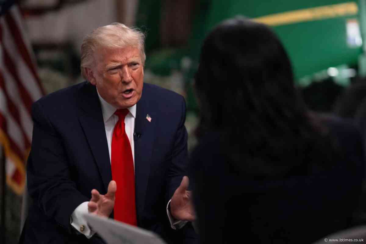 Donald Trump's 'Swollen' and 'Unkempt' Interview Look Prompts Dementia Claims