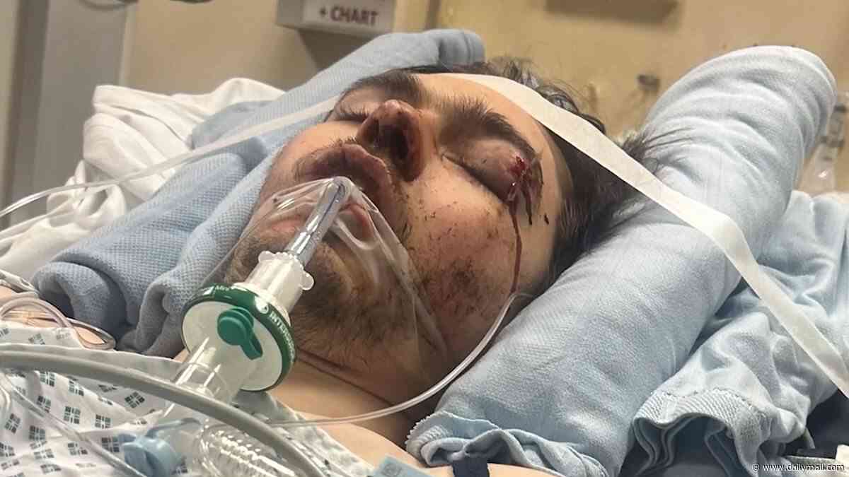 Moment man, 22, is mowed down by a drunk and drug-fuelled motorbike rider in horror hit-and-run crash that left him with life-changing injuries
