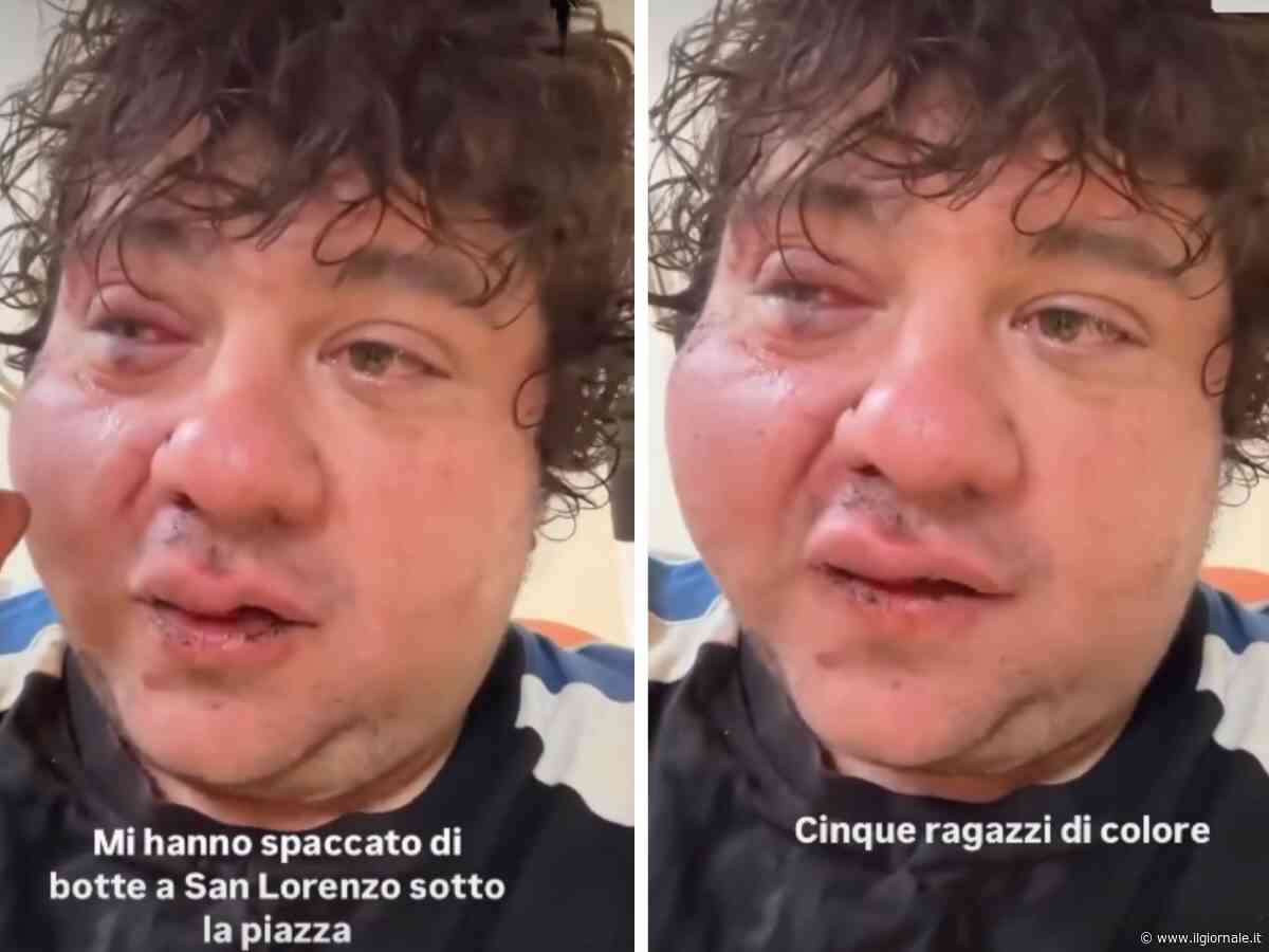 "Mi hanno spaccato di botte". Ex concorrente di X Factor aggredito da cinque stranieri
