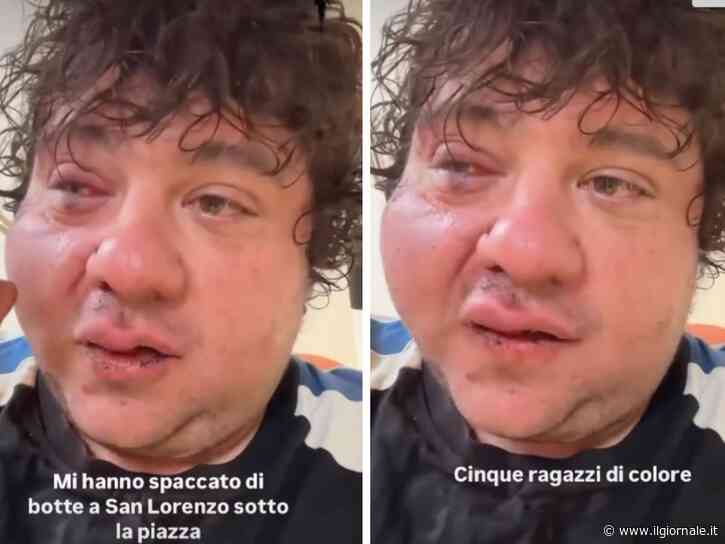 "Mi hanno spaccato di botte". Ex concorrente di X Factor aggredito da cinque stranieri