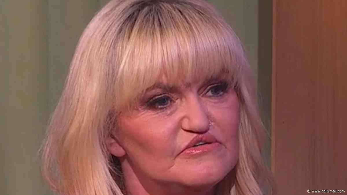 Danniella Westbrook, 52, reveals she will undergo six more procedures over 18 months to repair her face after unveiling the results of 'miracle' reconstructive surgery