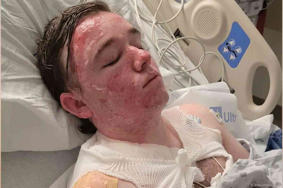 20-Year-Old Jacob Smith Admitted to ICU After Jalani Bluett Throws Hot Oil at a McDonald's; Fundraiser Reaches $96K