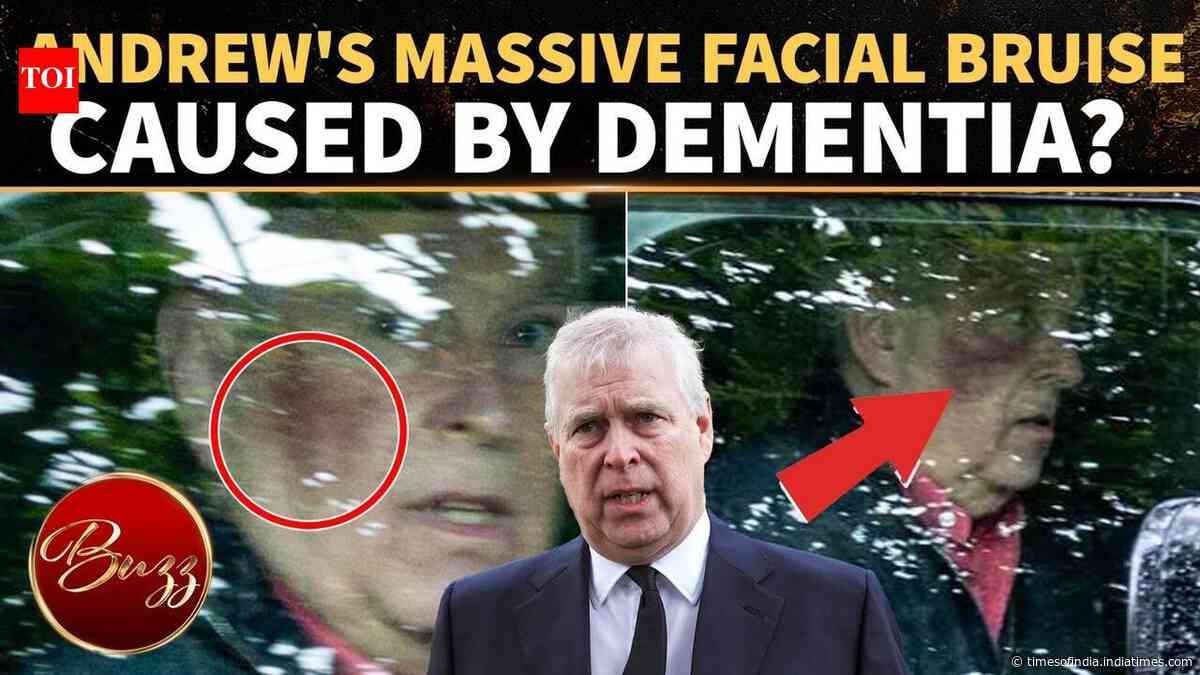 Andrew Windsor's Facial Injury Sparks Dementia Speculation After Insiders Sound Alarm