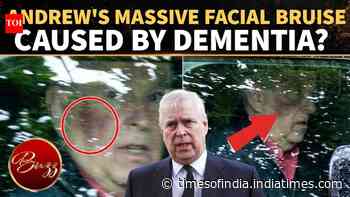 Andrew Windsor's Facial Injury Sparks Dementia Speculation After Insiders Sound Alarm