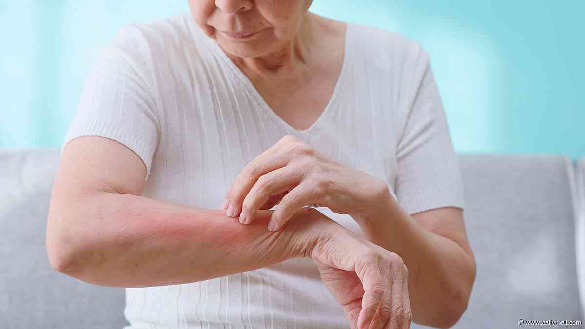 'I scratch so much in my sleep that I have to wear gloves - but still wake up to find I've broken skin': Neuropathic itching affects millions, but help IS at hand - DR MARTIN SCURR