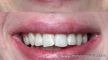 'I've used these 70p strips for 10 days and my teeth got whiter after each use'