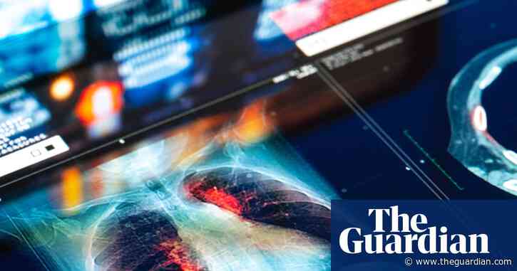 Doctors and NHS could be sued for mistakes made by AI tools, report warns