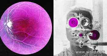 Longevity Startup Doses First Human in Bid to Reverse Age-Related Sight Loss