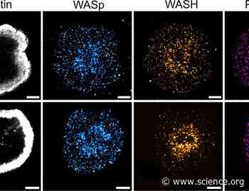 PTPN22 regulates T cell synapse formation through PSTPIP1-dependent actin remodeling | Science Signaling