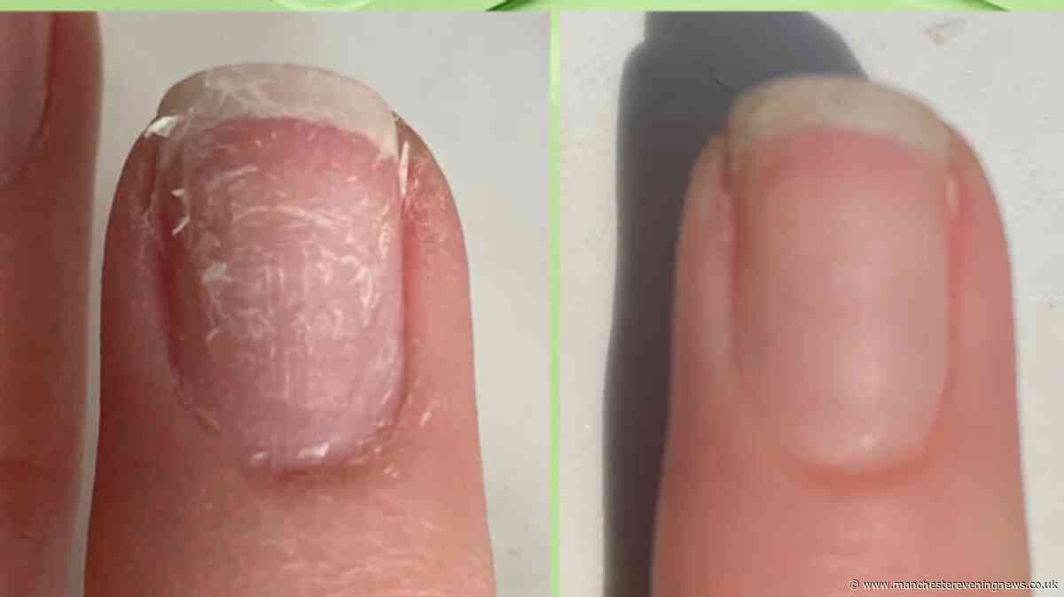 Cleaner-approved repair treatment 'makes a real difference' to damaged nails