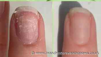 Cleaner-approved repair treatment 'makes a real difference' to damaged nails