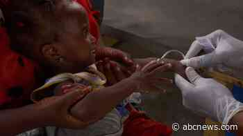 Nigeria’s conflict-hit Borno state battles cholera outbreak that has killed 74