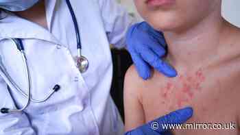 Two deaths confirmed as highly contagious virus spreads in UK