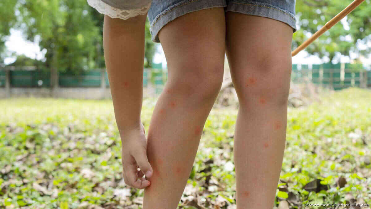 Dieser Alltagstipp halbiert laut Studie die Mückenanziehung bei Kindern