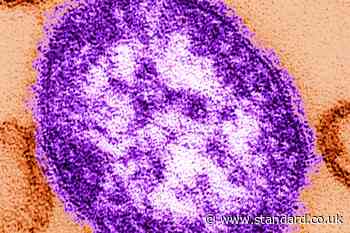 Two children die from measles as more cases confirmed in London this month