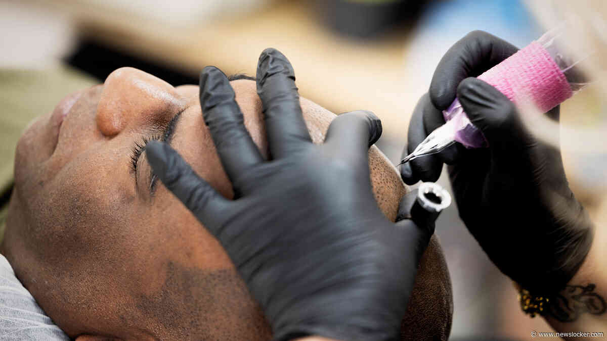 Getatoeëerde haarlijn wordt steeds populairder: duizenden behandelingen per jaar