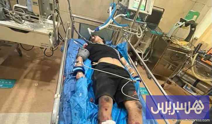 عائلة طالب مغربي تناشد التدخل الملكي بعد حادثة سير خطيرة بالصين