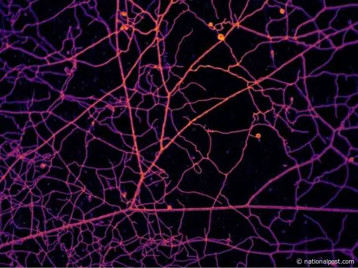 Study maps quadrillion-mile fungus web lurking in topsoil