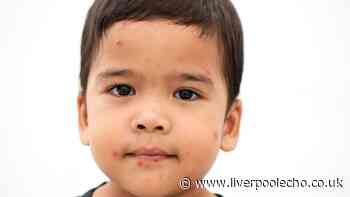Measles symptoms warning to parents as cases rise and two die - full list