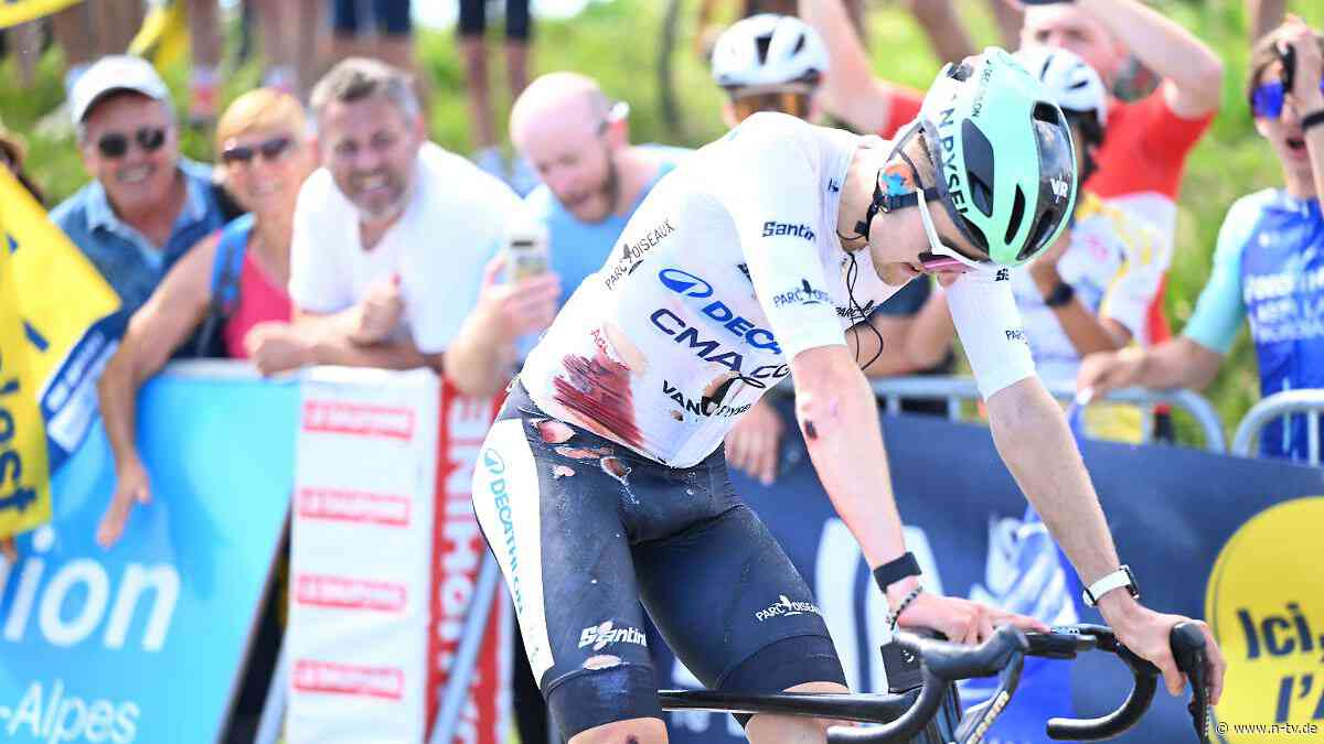 "Keine Entschuldigung": Rad-Toptalent blutet Weißes Trikot voll