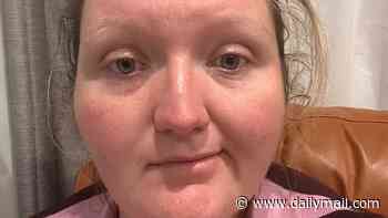 Exhausted mum who woke up with half her face paralysed blames the stress of the NDIS for her condition
