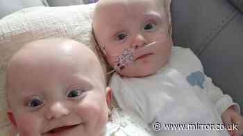 'Miracle' twins born 17 weeks early - one with hands the size of her dad's fingernail