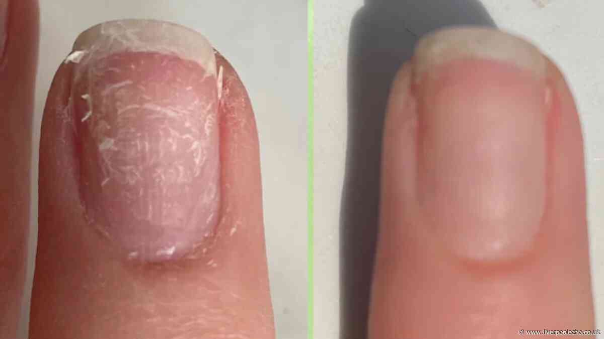 Gardener repairs 'broken, weak and peeling' nails with £19 serum