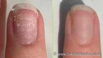 Gardener repairs 'broken, weak and peeling' nails with £19 serum