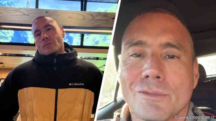 Pancho Saavedra reveló que se sometió a implante capilar: "Me estaba afectando el autoestima"