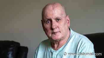 Cyclist, 66, had a quarter of his skull removed after hitting a fly-tipped shed on a country road