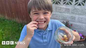 Our son's 20 allergies are so complex he has to travel to the US for regular treatment