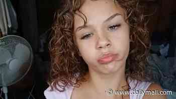 Girl, 15, fighting for her life after dad says she swallowed too much Benadryl in twisted 'challenge'
