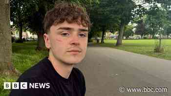 Stabbing survivor says bleed kit can save lives
