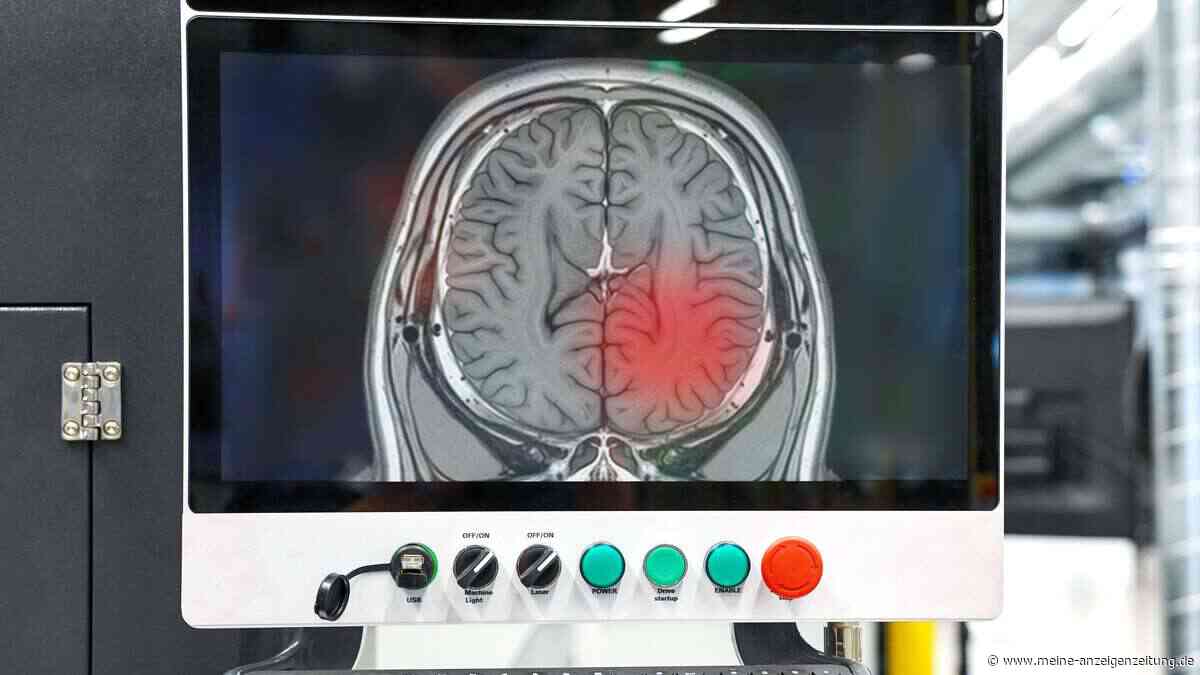 Hirntumor-Diagnose in Minuten statt Wochen: Neue KI erkennt über 100 Varianten