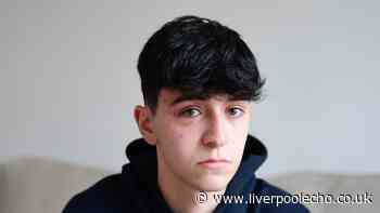 Teen punched so hard doctors thought he'd been hit with a metal bar